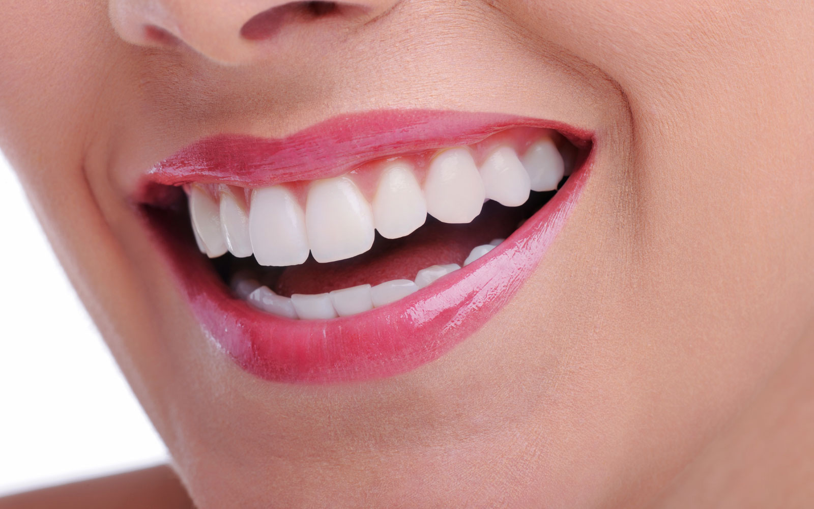 Teeth Whitening